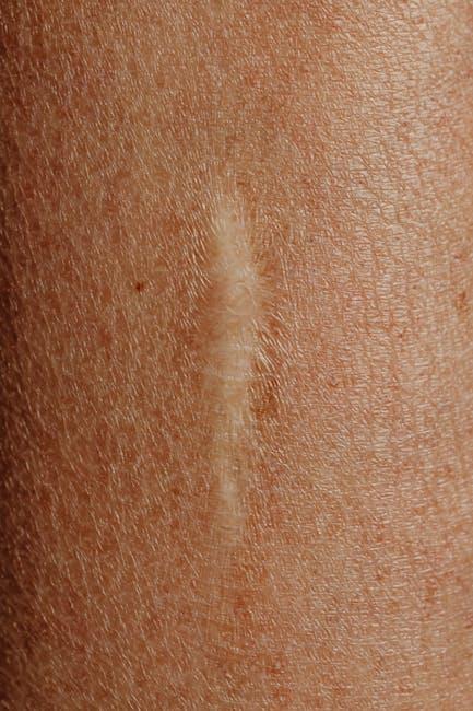 Effective Home Remedies to Speed Up Recovery